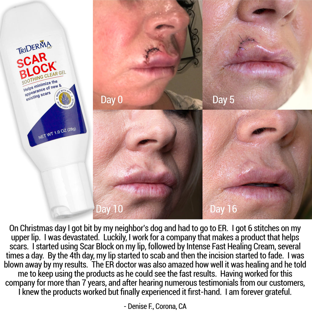 Scar Block Silicone Gel for New and Old Scars
