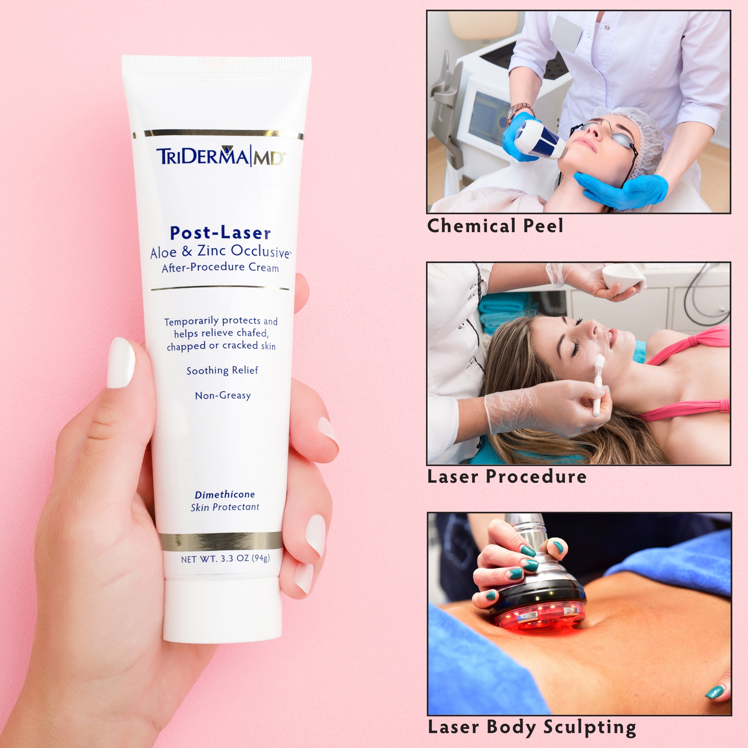 Post-Laser Recovery Cream for Sensitive Skin | Calm, Soothe & Restore